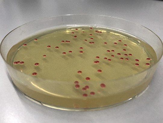 Knospende Hefen Knospende Hefen